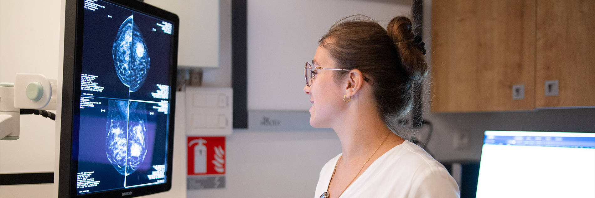 déroulement d'une mammographie